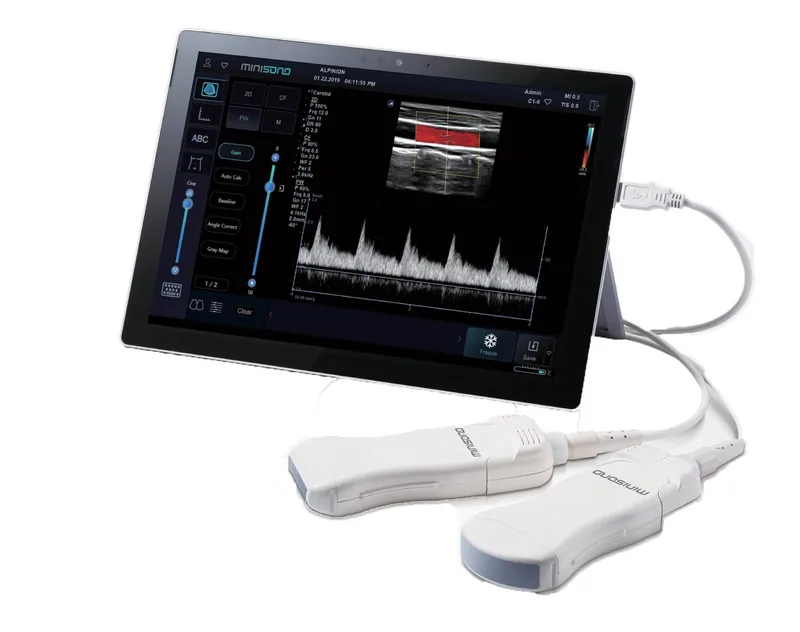 ALPINION MiniSono ultrasound machine