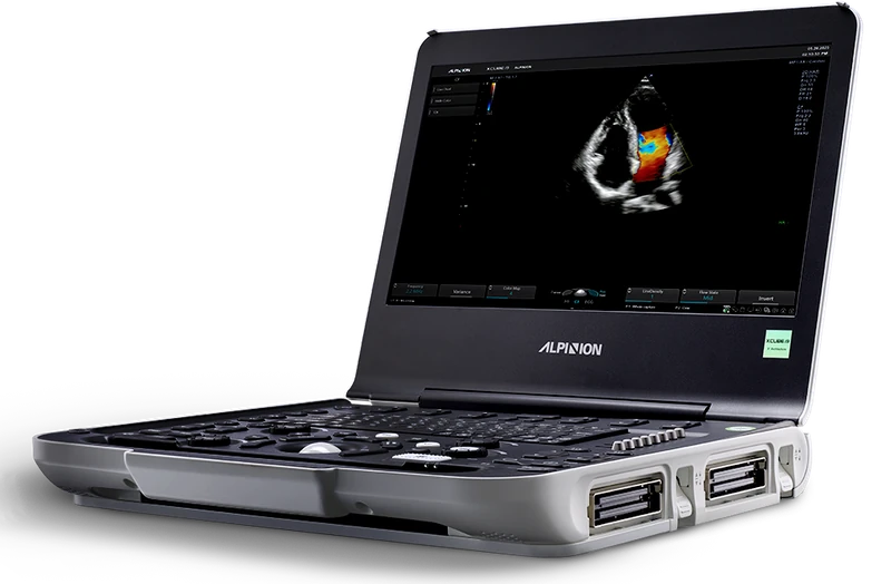 ALPINION X-CUBE i9 ultrasound machine