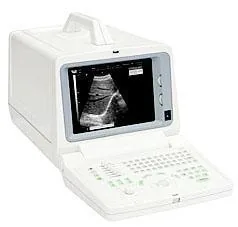 CHISON 600M ultrasound machine
