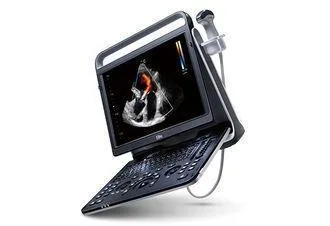 CHISON EBit 50 ultrasound machine