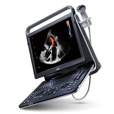 CHISON EBit 60 ultrasound machine
