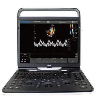 CHISON EBit 60 VET ultrasound machine