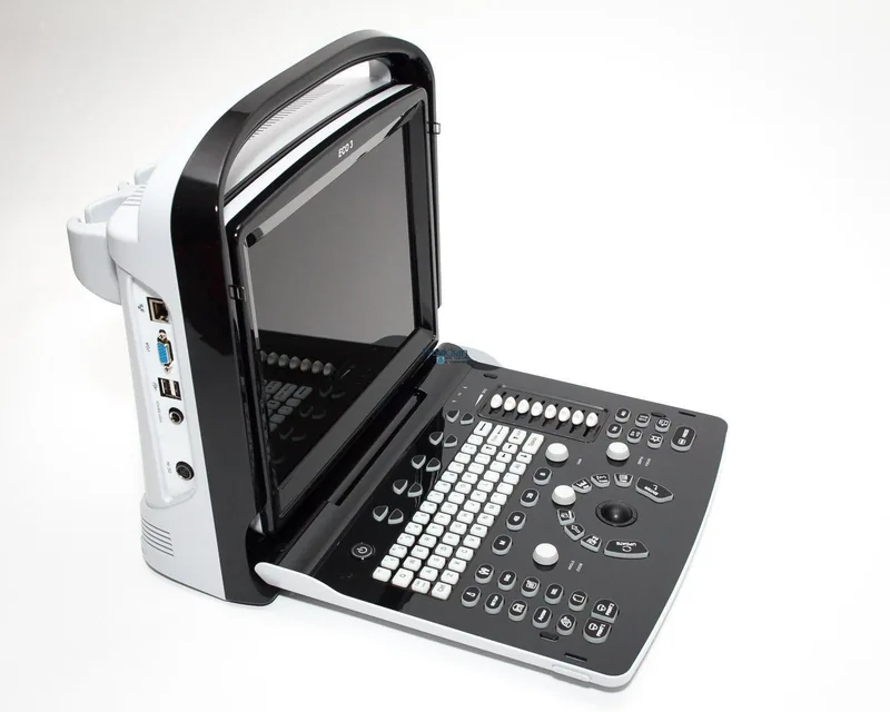 CHISON ECO 3 ultrasound machine