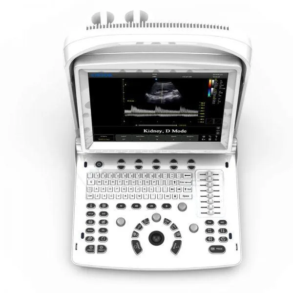 CHISON ECO 3 EXPERT VET ultrasound machine