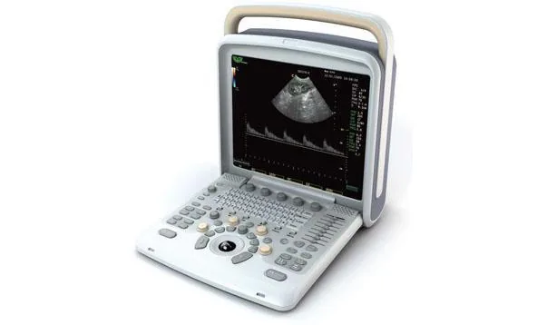 CHISON Q6 ultrasound machine