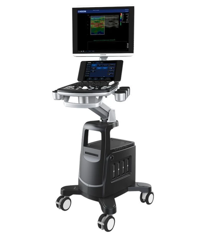 CHISON QBit 10 ultrasound machine