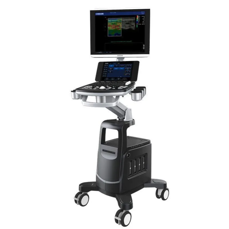 CHISON QBit 11 ultrasound machine