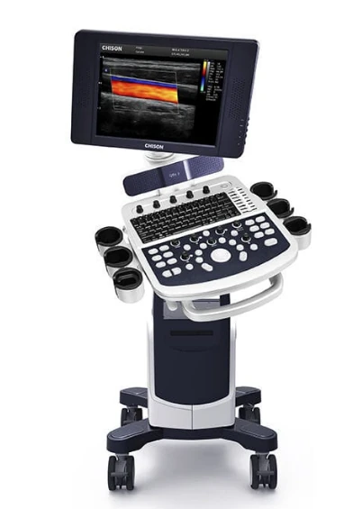 CHISON QBit 3 ultrasound machine