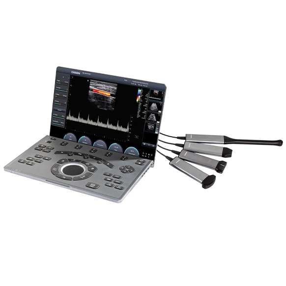 CHISON SonoAir 30 ultrasound machine