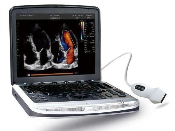 CHISON SonoBook 8 ultrasound machine
