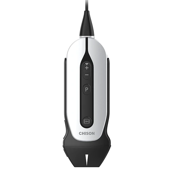 CHISON SonoEye P1 ultrasound machine