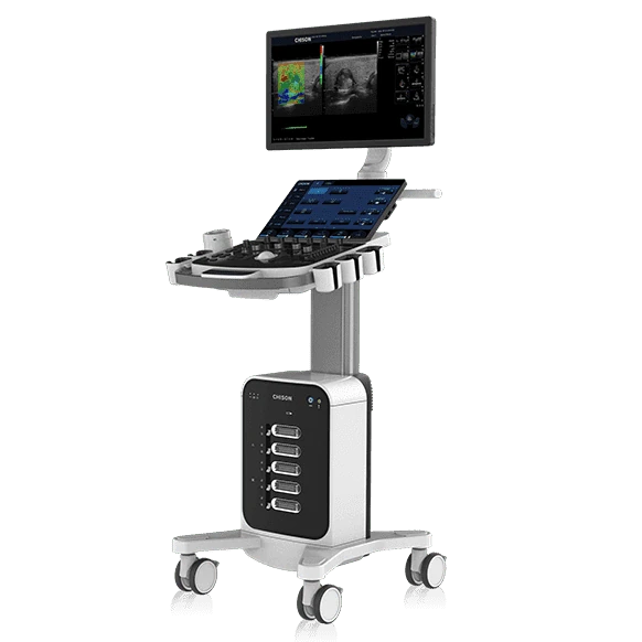 CHISON SonoMax 7 ultrasound machine