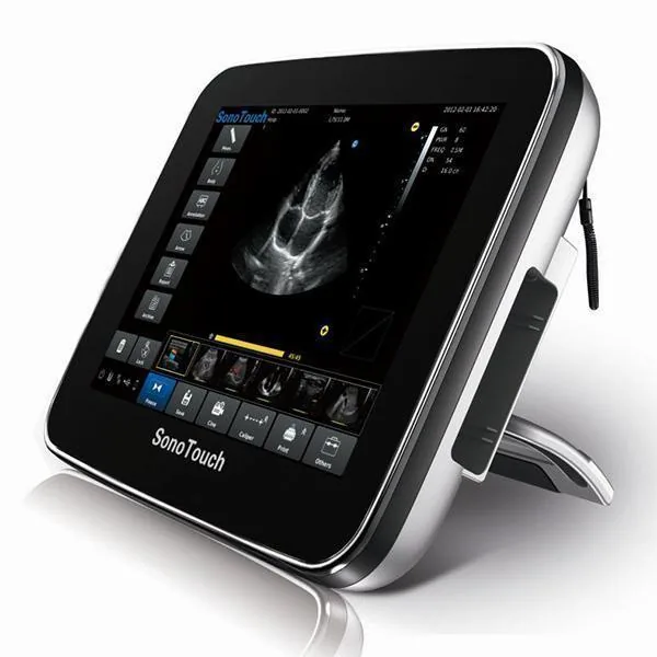 CHISON SonoTouch 10 ultrasound machine