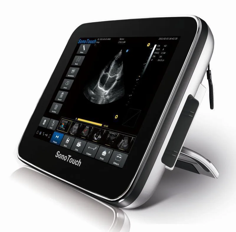 CHISON SonoTouch 20 ultrasound machine