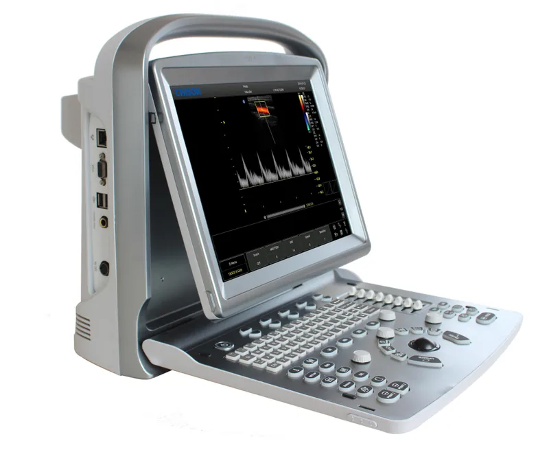 CHISON SonoTouch 50 ultrasound machine