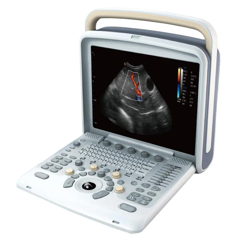 CHISON SonoTouch 80 ultrasound machine