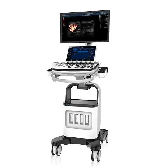 CHISON XBit 80 ultrasound machine