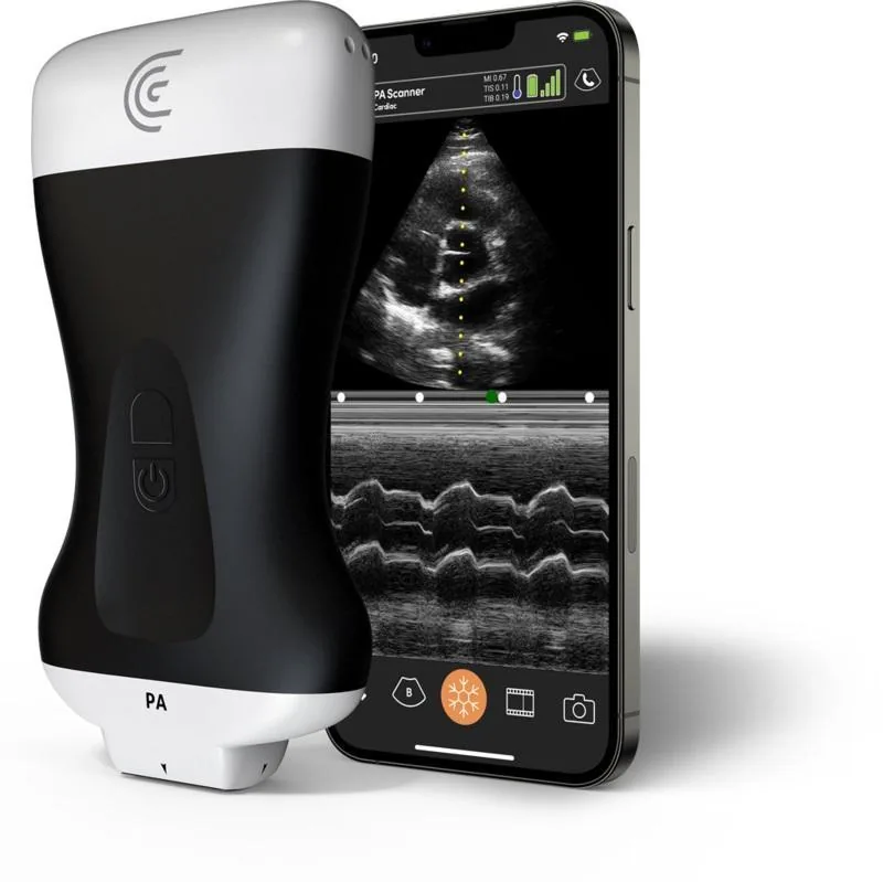 CLARIUS PA HD3 ultrasound machine