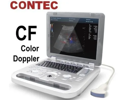 CONTEC CMS1700A ultrasound machine