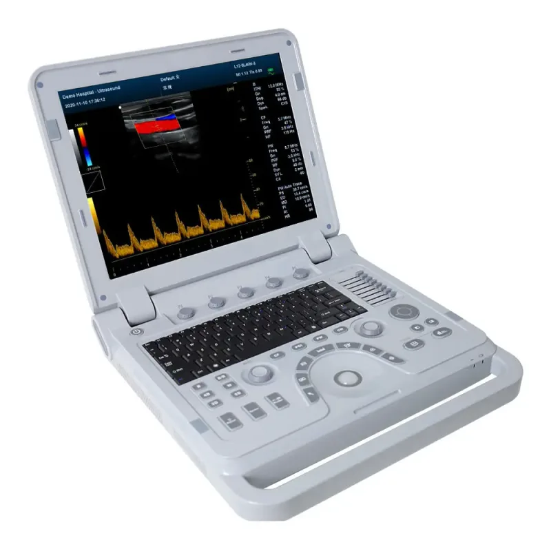 CONTEC CMS1700B ultrasound machine