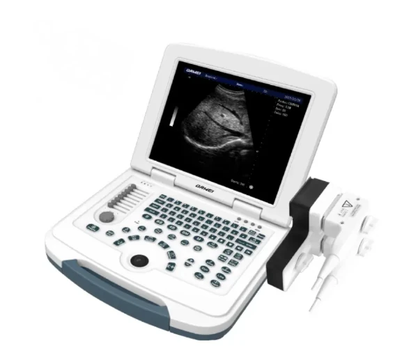 DAWEI DW-580 ultrasound machine