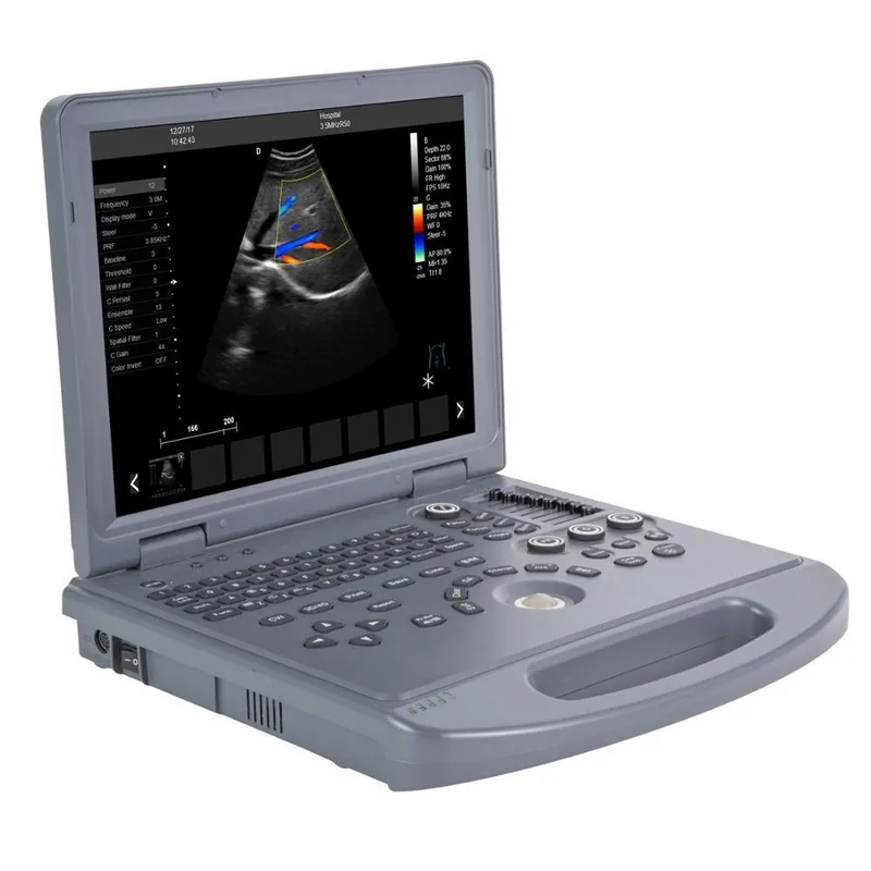 DAWEI DW-C60 ultrasound machine