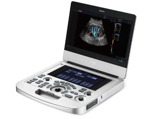 EDAN Acclarix AX2 ultrasound machine