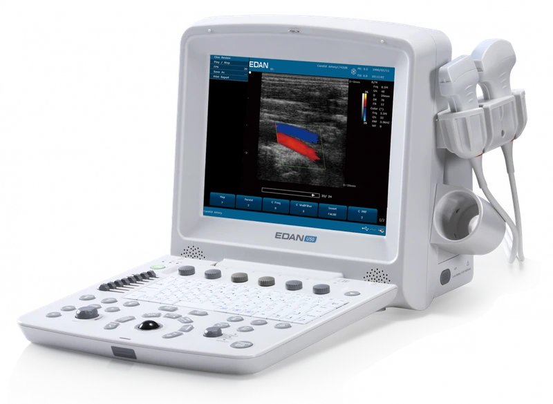 EDAN U50 ultrasound machine