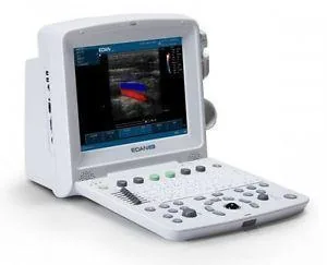 EDAN U50 Prime ultrasound machine