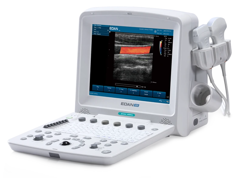 EDAN U50 Vet ultrasound machine