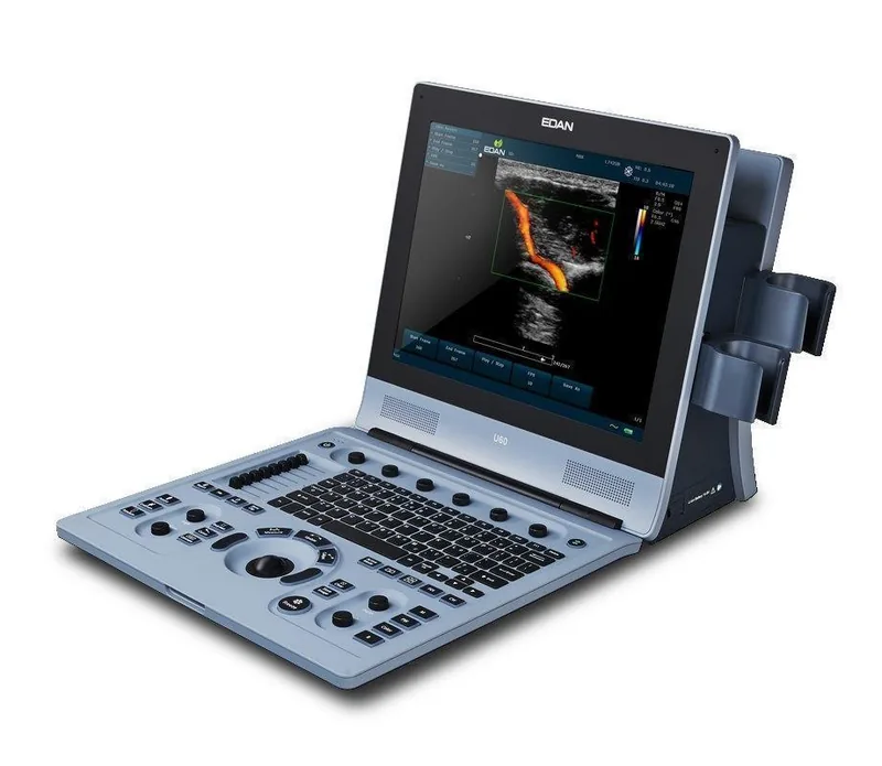 EDAN U60 ultrasound machine