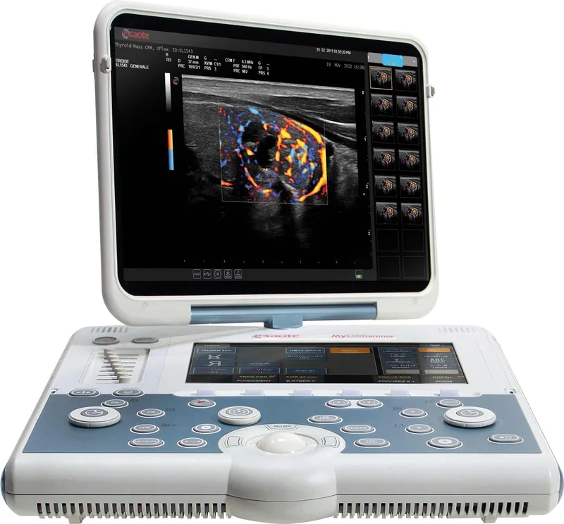 ESAOTE MyLab Gamma ultrasound machine