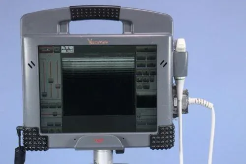 ESCALON VascuView ultrasound machine
