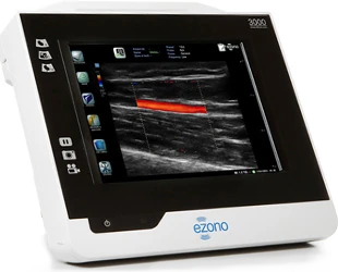 EZONO 3000 ultrasound machine