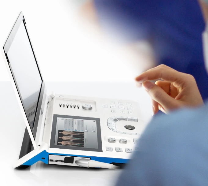 EZONO 5000 ultrasound machine