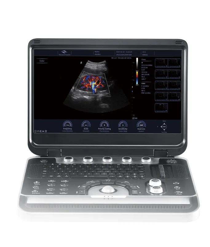 FOCUS & FUSION Finus 50 ultrasound machine