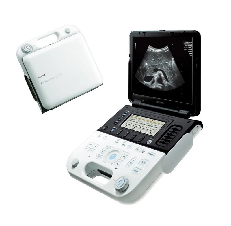FUJIFILM FAZONE CB ultrasound machine