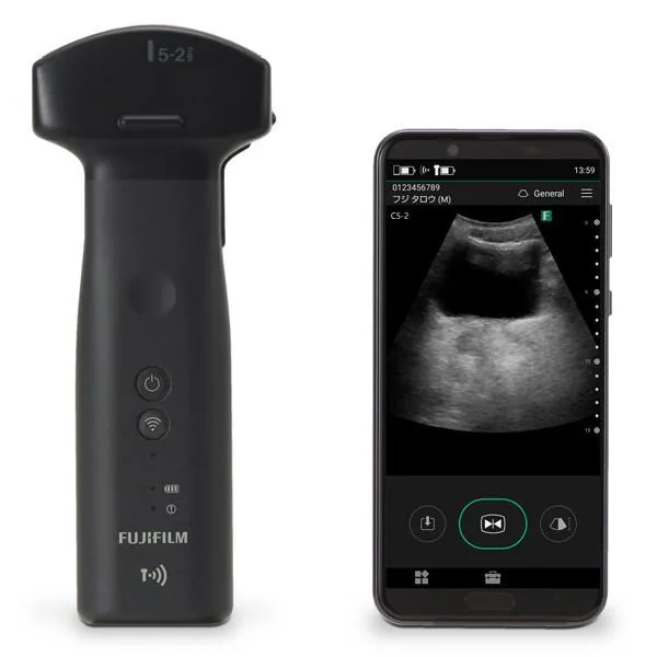 FUJIFILM Iviz ultrasound machine