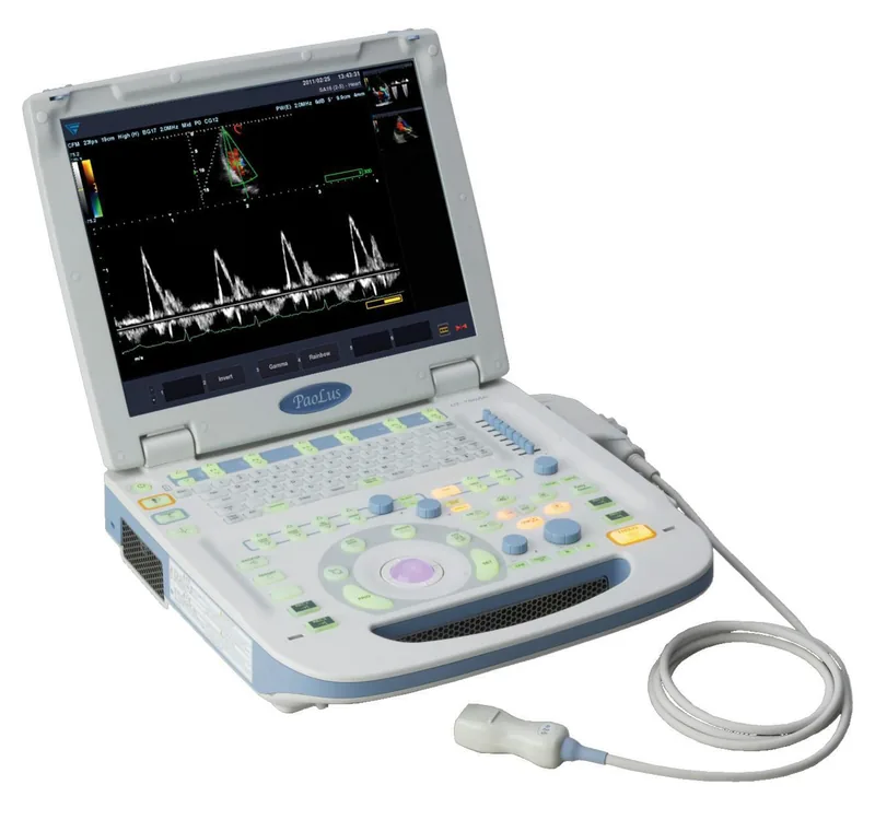 FUKUDA DENSHI UF-760AG ultrasound machine