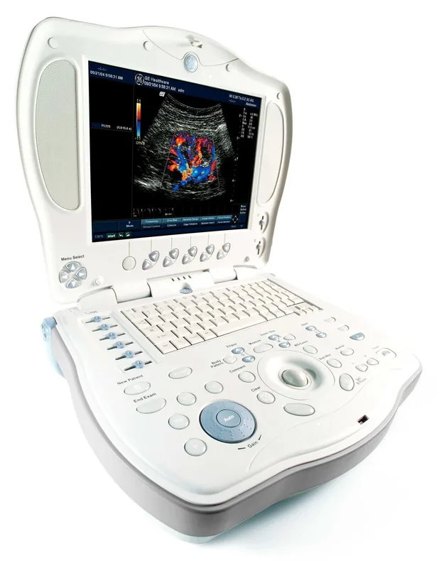 GE Logiq Book ultrasound machine