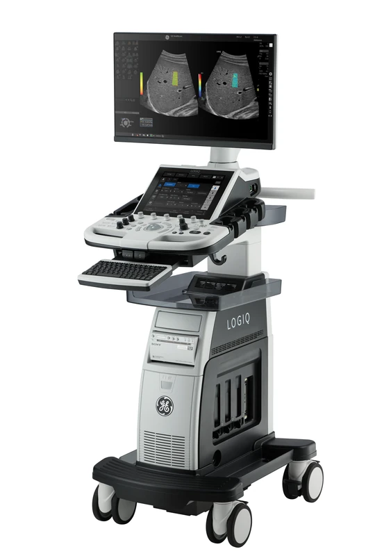 GE Logiq P10 XDclear ultrasound machine