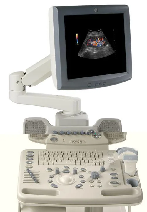 GE Logiq P5 Pro ultrasound machine