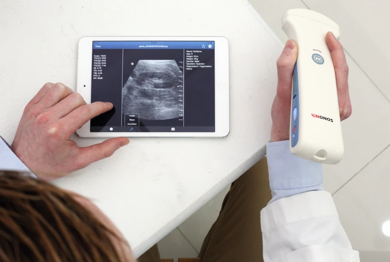 HEALCERION SONON 300C ultrasound machine