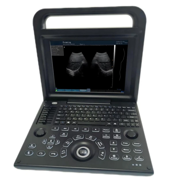 HEALICOM HBW-4P ultrasound machine