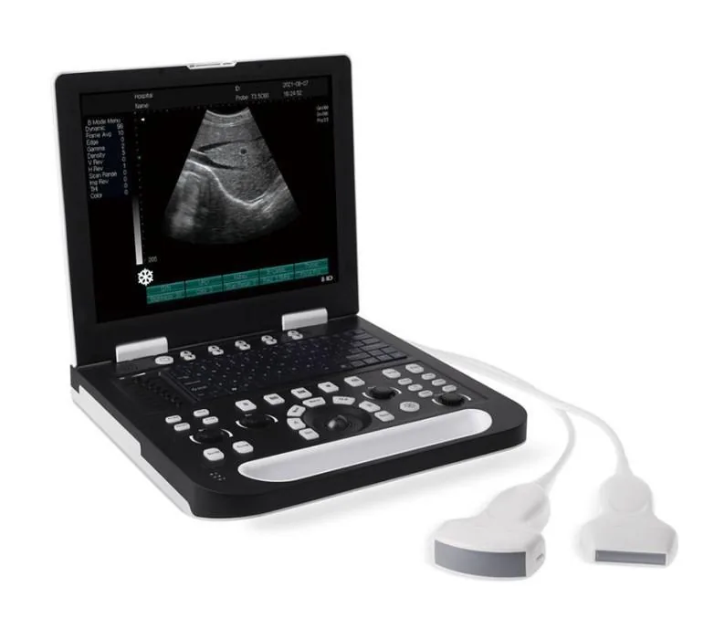 HEALICOM HBW-8 ultrasound machine