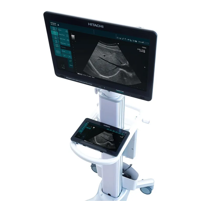 HITACHI ARIETTA Precision ultrasound machine