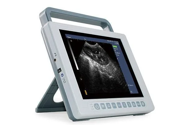 KAIXIN K10 ultrasound machine
