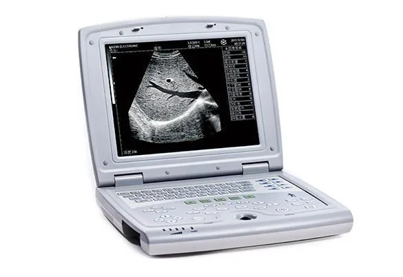 KAIXIN KX5000 ultrasound machine
