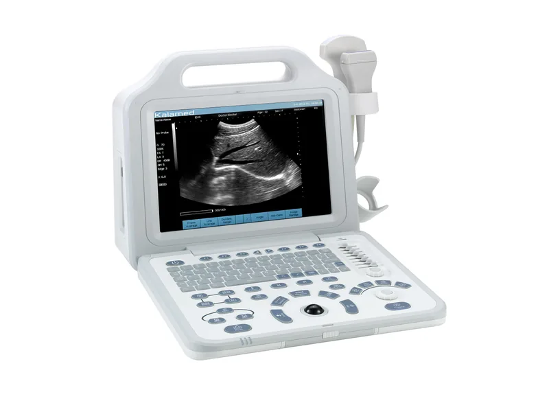 KALAMED KUP-101 ultrasound machine