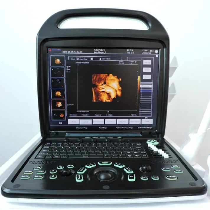 KONTED C9 PLUS (3D/4D) ultrasound machine